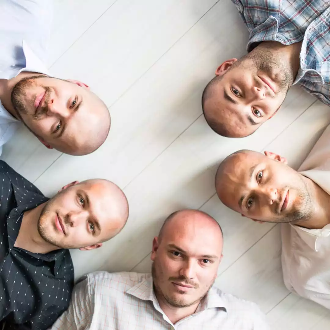 signs of balding