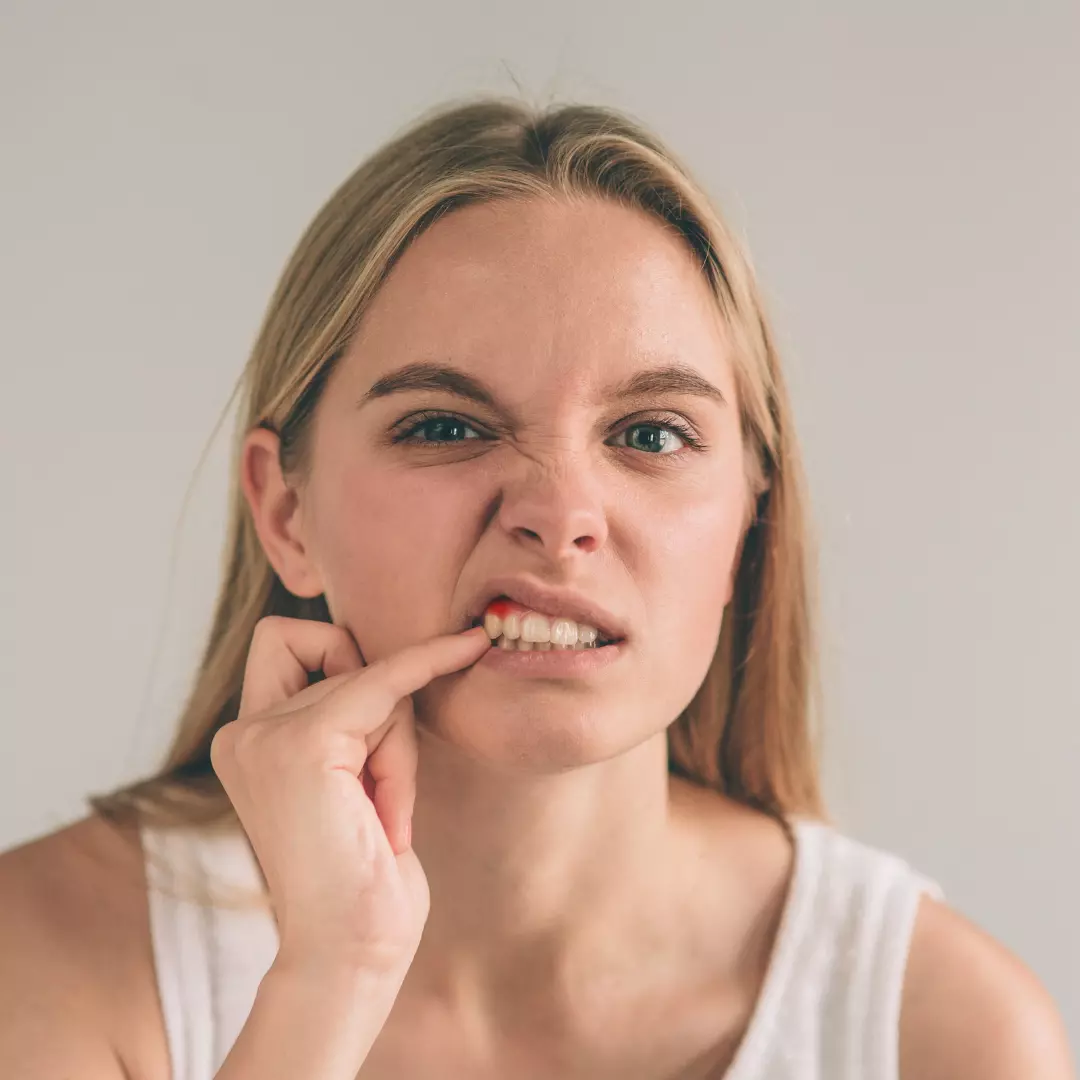 can receding gums be reversed 1 1